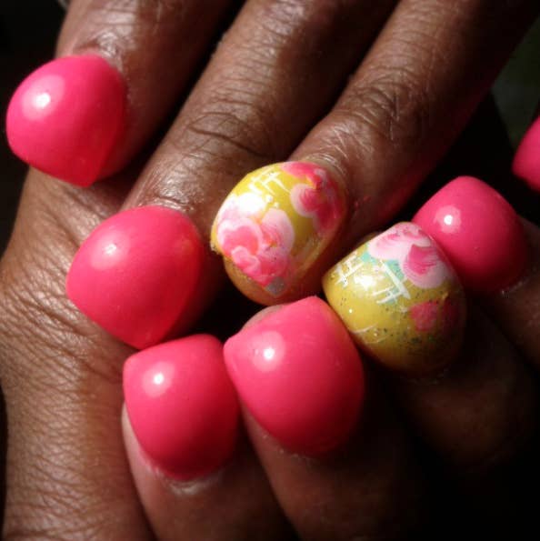 17 Times Finger And Toe Nails Went Really, Really Far