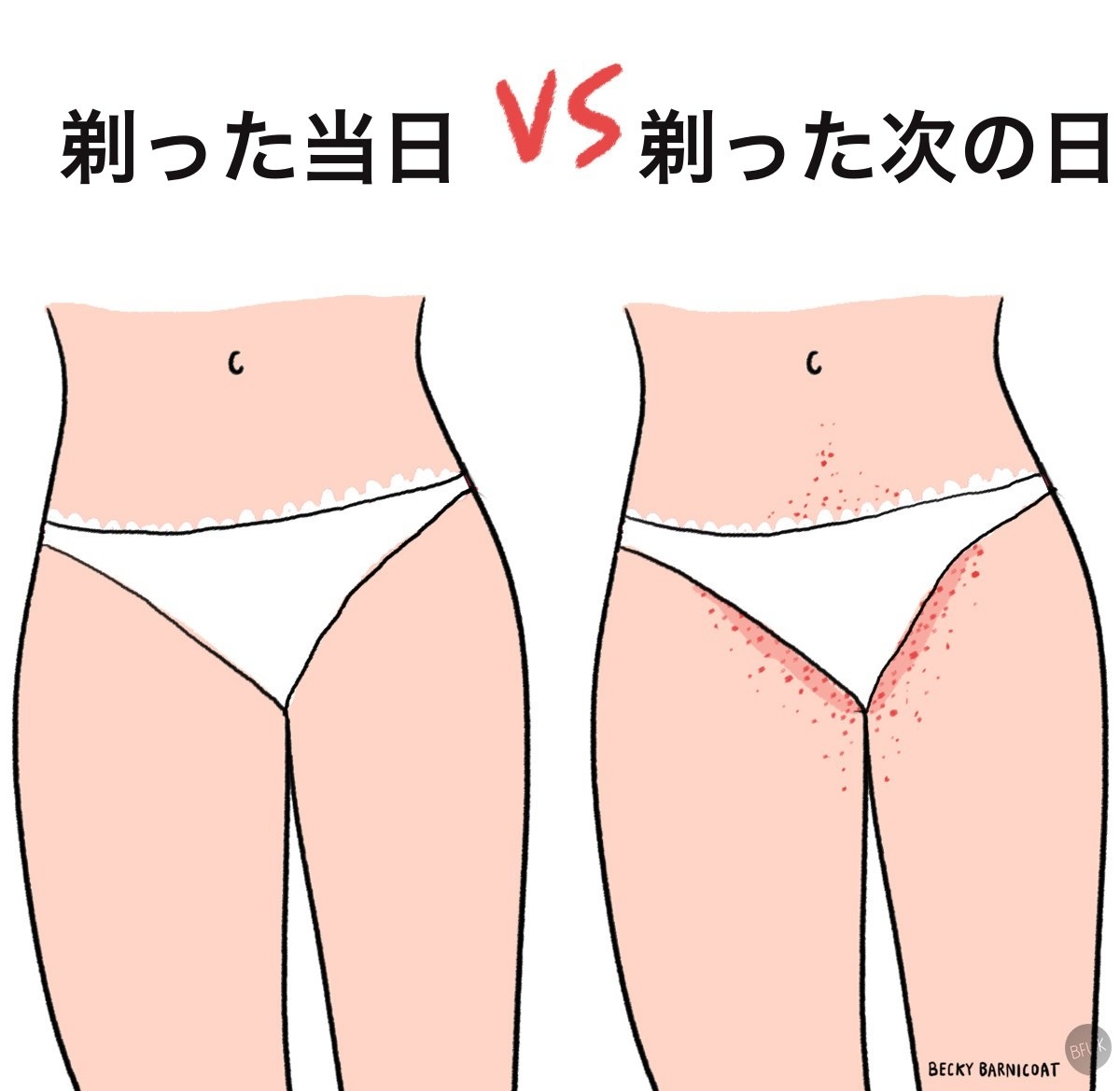 剃っても剃っても生えて来る 毛の処理に奮闘する私たち