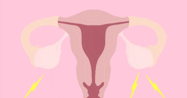 Tell Us What It's Like To Have PCOS