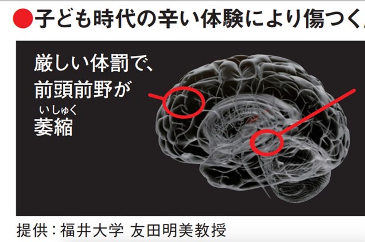 体罰 暴言で子どもの脳が 萎縮 変形 厚労省研究班が注意喚起