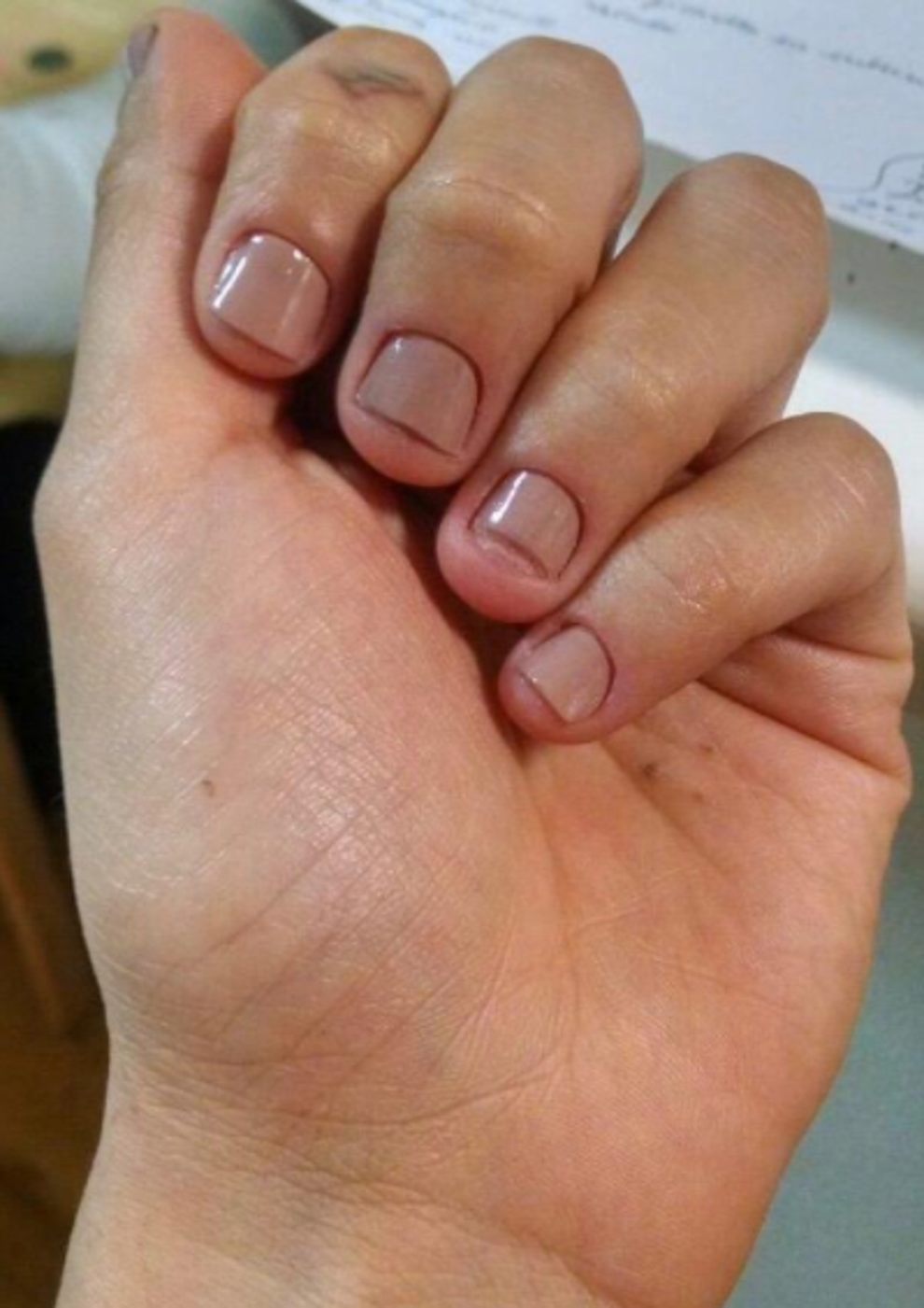 15 Practical Tips To Help You Quit Biting Your Nails 15 Practical Tips To Help You Quit Biting Your Nails