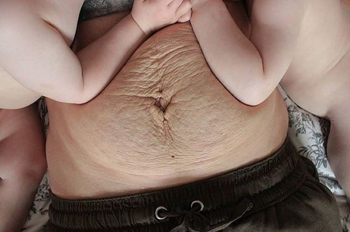 Moms And Their Post-Pregnancy Bodies Are Strong And Amazing, And