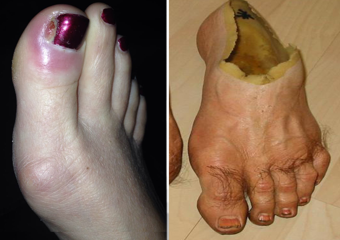This Man's Callus-Shaving Video Went Viral. Here's What a Podiatrist Thinks