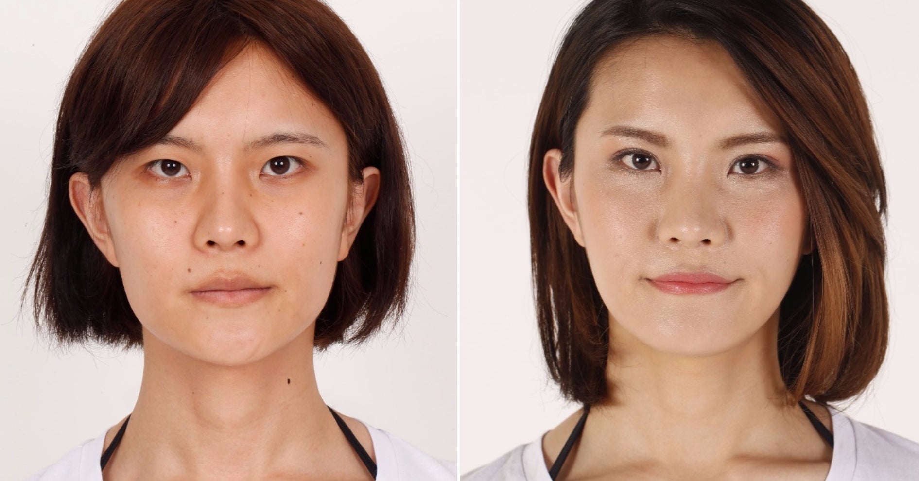 生まれたときは 男の子だったシンデレラ 整形は彼女に 魔法 をかけたのか