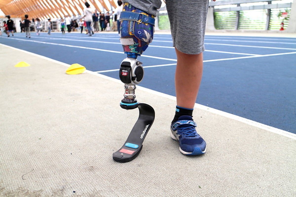 病気で足を失ったら 走るのが楽しくなった 当事者が語る障害者スポーツのリアル
