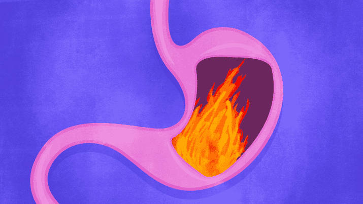 "It can be embarrassing talking about things like diarrhea, bloating, and gas, but don't keep quiet about them just because they’re uncomfortable topics to bring up. Make sure you see a gastroenterologist and be very detailed when explaining what you’re experiencing. The more info you give, the higher the likelihood that a gastro can properly diagnose you and treat you."—Shelby Thompson, Facebook