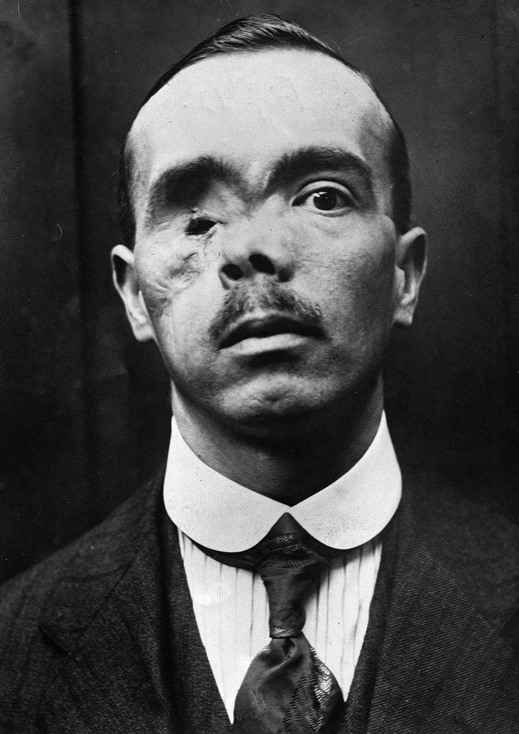 第一次世界大戦の戦線からの、この世の終わりのような写真28枚