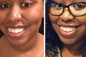 Braces Take this quiz with friends in real time and compare results. braces