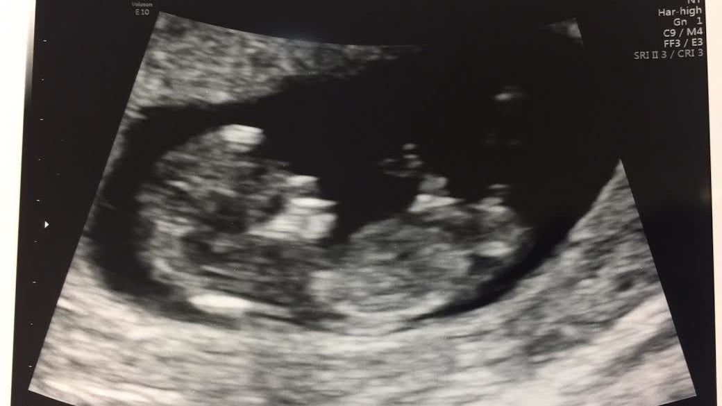 1st Trimester My Baby At 10 Weeks Old In The Womb 17 Truths About