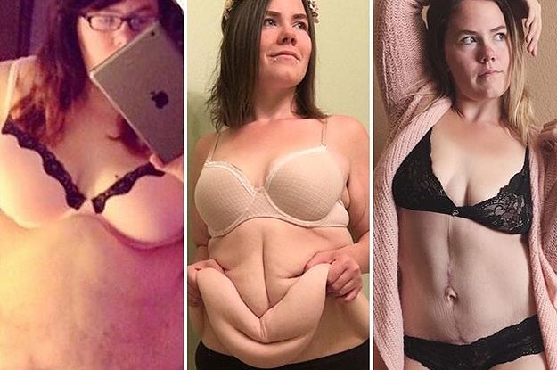 Women Are Posting Photos Of Themselves In Their Underwear To Share A  Body-Positive Message