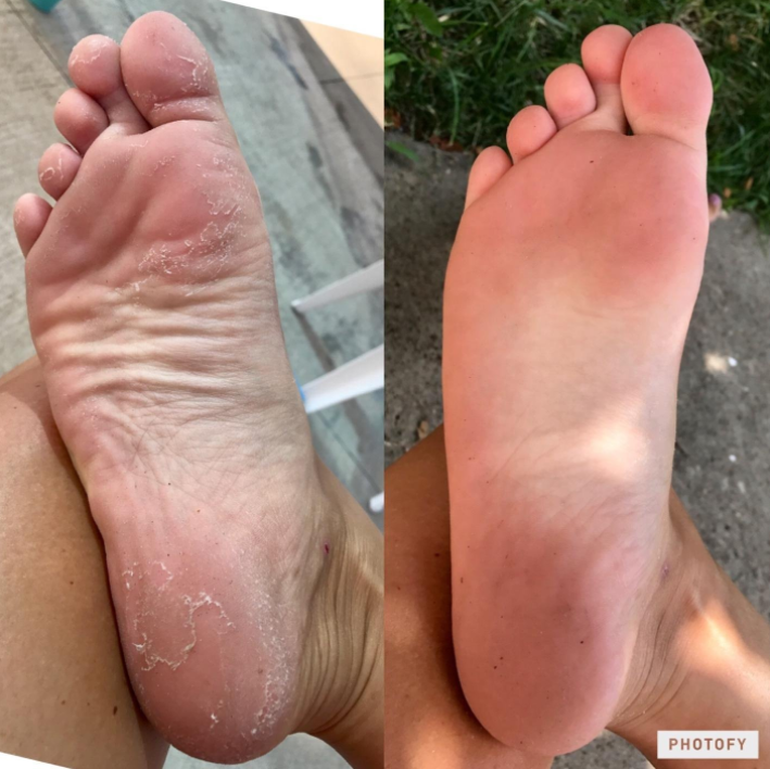 best foot exfoliation