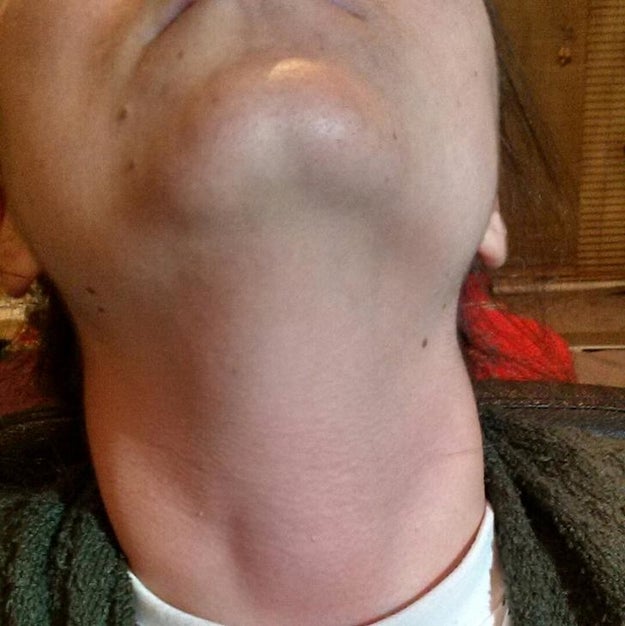 This chin is NOT OK: