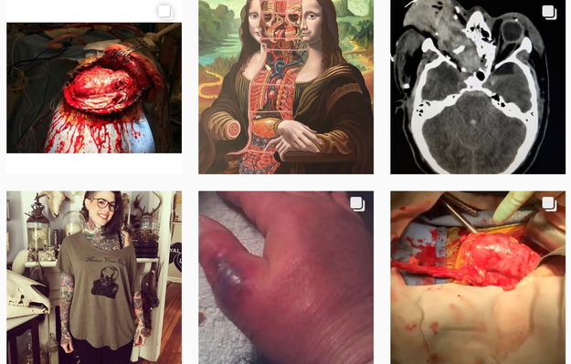 This Instagram account by Nicole Angemi, a pathologist's assistant, showcases organ dissection, autopsies, and gruesome injuries. The images, while gory in nature, are humanized by her captions, giving an honest insight into the human body and death.