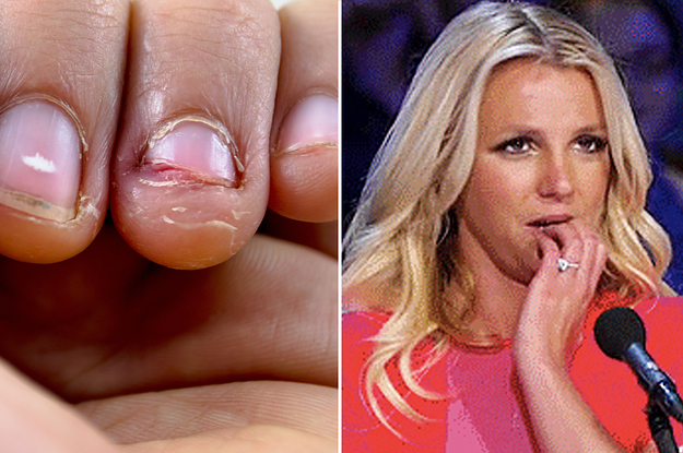 Is biting my nails really that bad? - Harvard Health