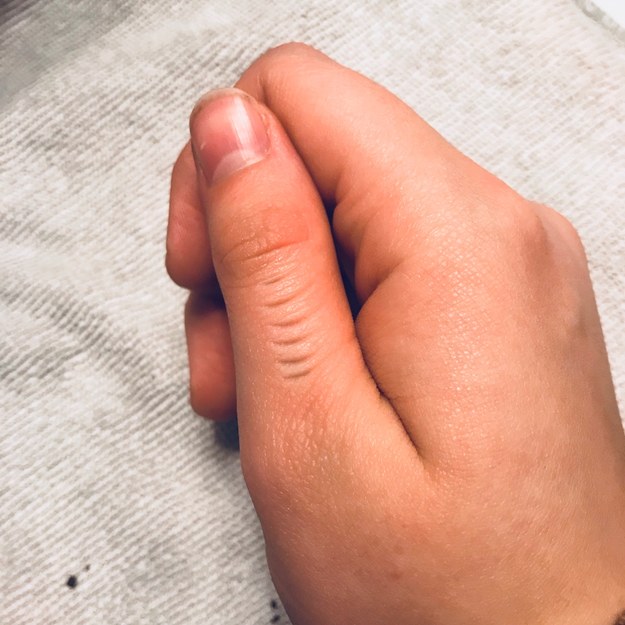 Digging Nails Into Skin Anxiety Best Nail Designs 2018 Baebaecee On Buzzfeed