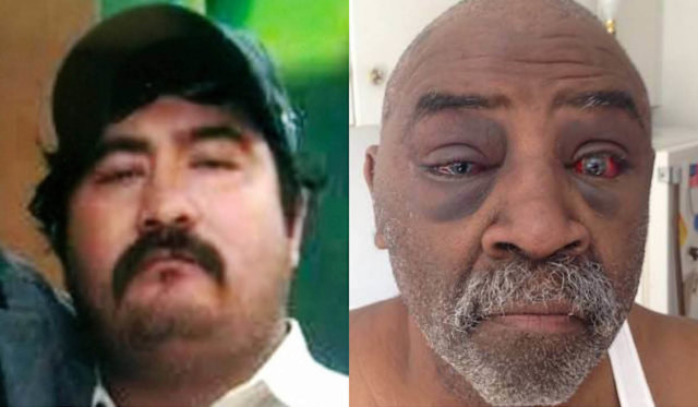 • The case of Daniel Harris, who was shot by North Carolina state trooper following a traffic infraction, was dropped in January 2017 with no charges to the officer. • In September 2017, Magdiel Gonzalez was shot and killed by police right outside of his home in Oklahoma City while neighbors shouted to the police that he could not hear them. In 2014 Pearl Pearson (then 64 years old) was beaten by Oklahome State troopers on the side of the road because he did not comply with orders he could not hear. Just this year, the case against Pearson was dismissed because the court did not want to pay the cost of interpreters.