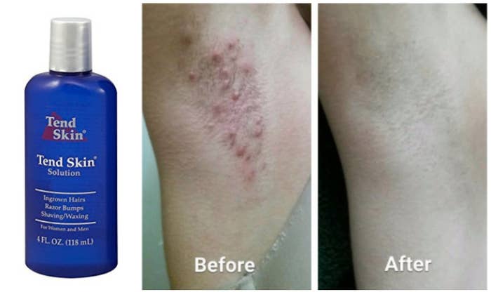 15 Beauty Product Before And After Photos That Will Make You A