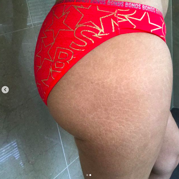 Stretch Marks Black Ass Selfies