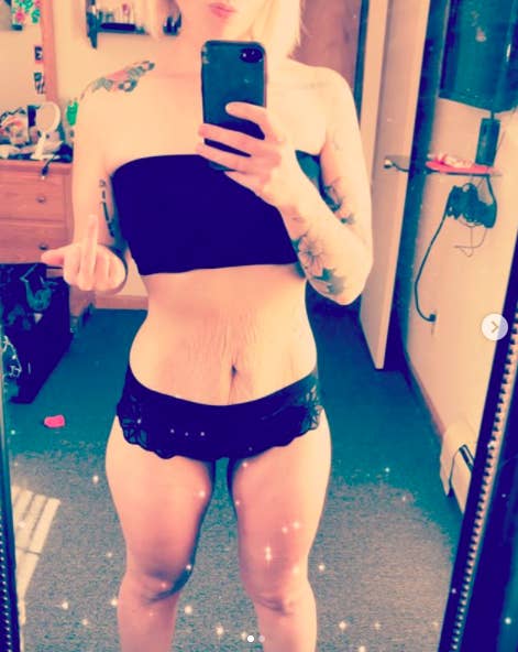 Women Are Sharing a Talk On Body Positivity By Posting Pics Of Their Stretch Marks