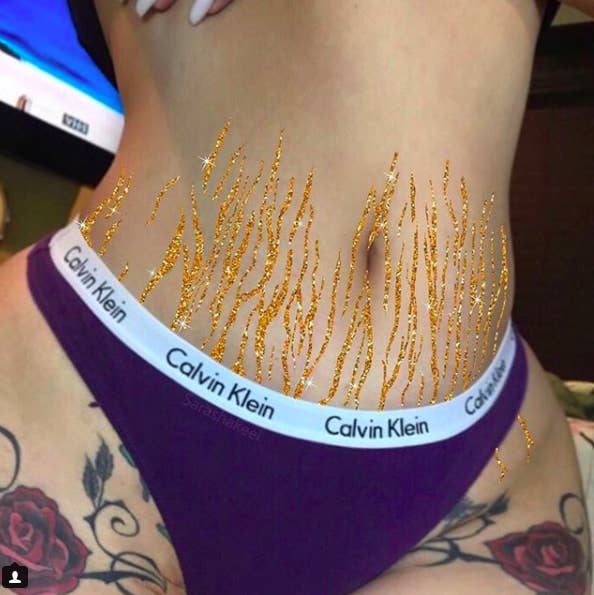 Women Are Sharing a Talk On Body Positivity By Posting Pics Of Their Stretch Marks