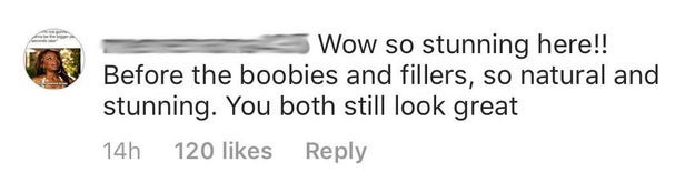But when someone decided to comment on the fact that she looked stunning "before the boobies and fillers", Chrissy really wasn't having it.