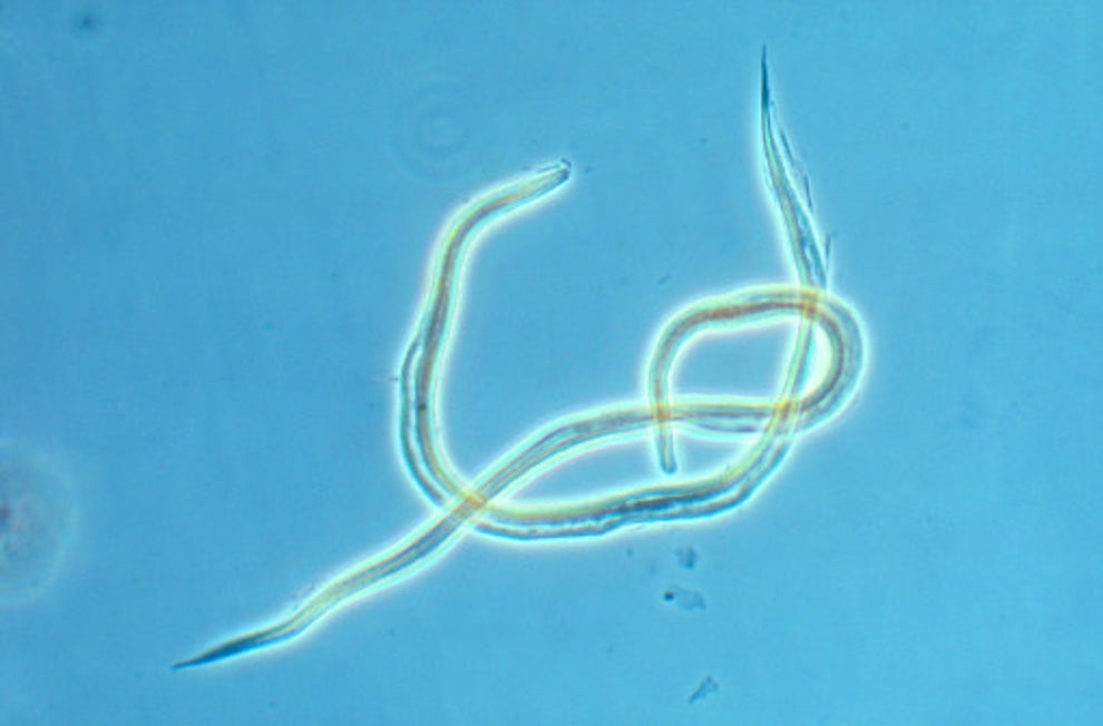 Couple Infected With Parasitic Hookworms At Beach Share Horrifying