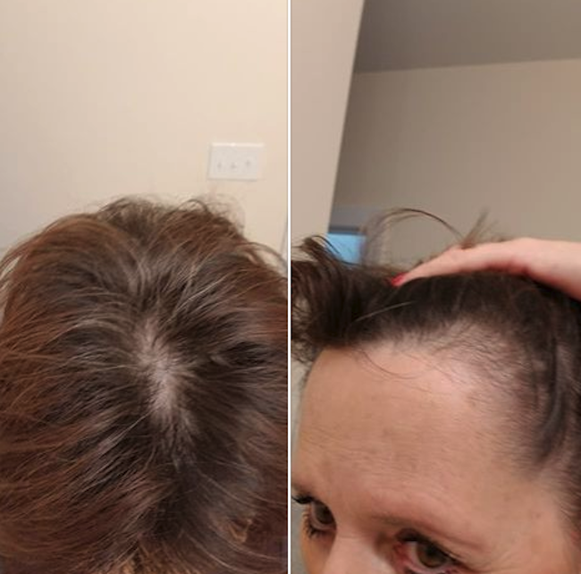 Monat Is Suing A Woman Who Said Their Products Are A "Nightmare"