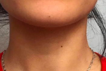 reviewer's lips looking smooth