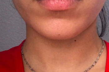 reviewer's lips looking chapped