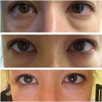 three photos of the bags under a reviewer's eyes fading