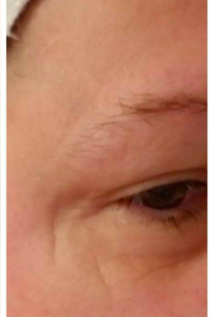 reviewer with deep crow's feet next to their eye