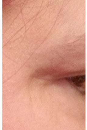 the crow's feet largely faded