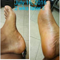 after photo dated july 16, 2 weeks later, with feet baby smooth