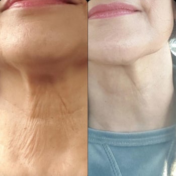 reviewer's neck with lots of fine lines, then smoother