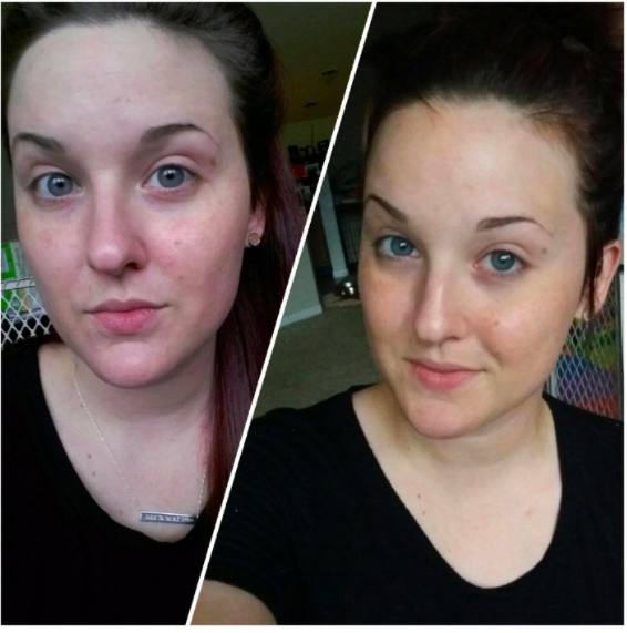 a before and after of a person&#x27;s face looking brighrer after using the serum