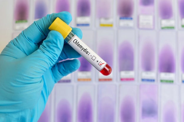 Many other sexually transmitted infections also disproportionately affect the black community.