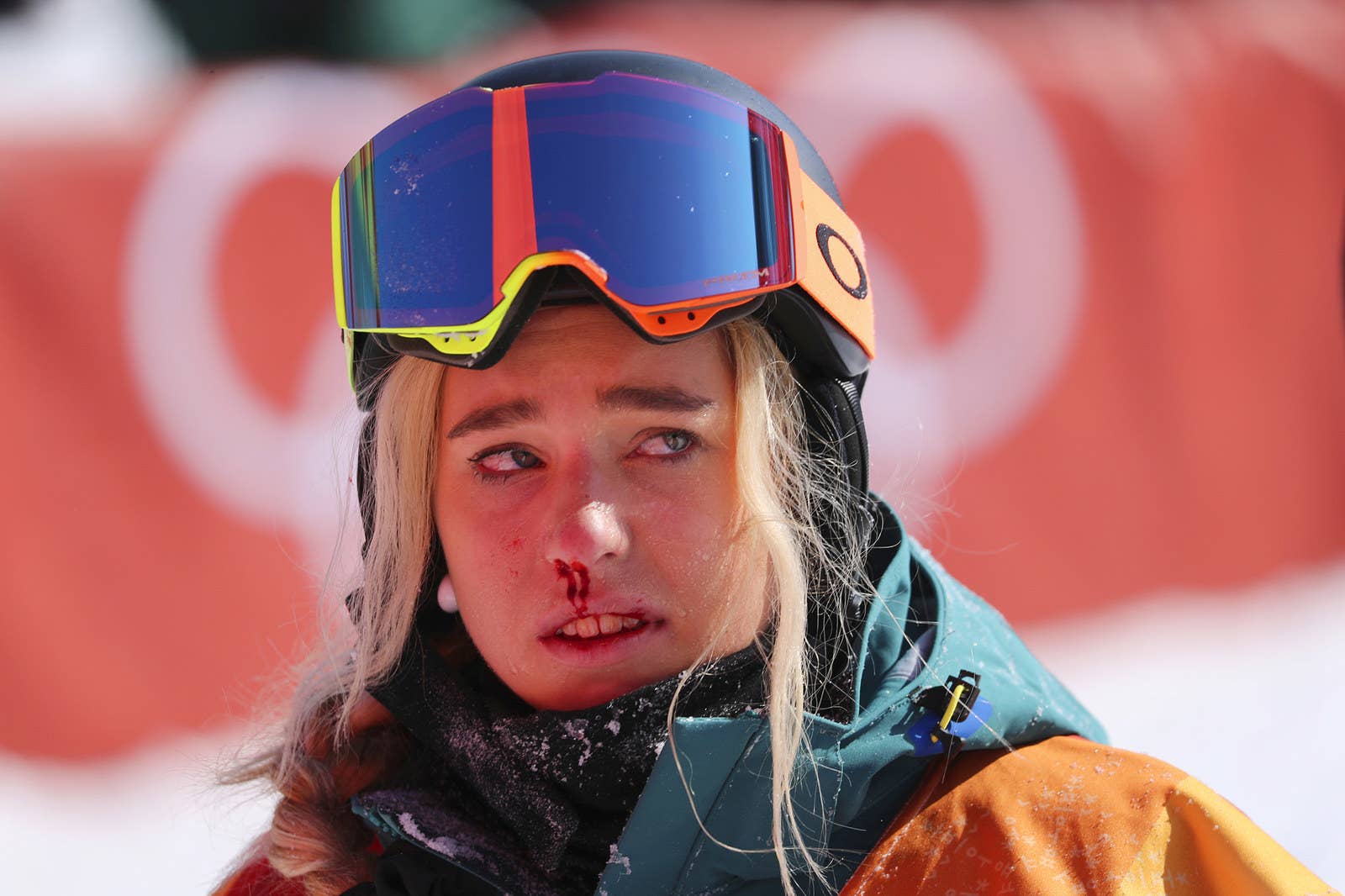 Emily Arthur of Australia is left bleeding after falling in her final run during the women's halfpipe final at the Pyeongchang 2018 Winter Olympics on Feb. 13.