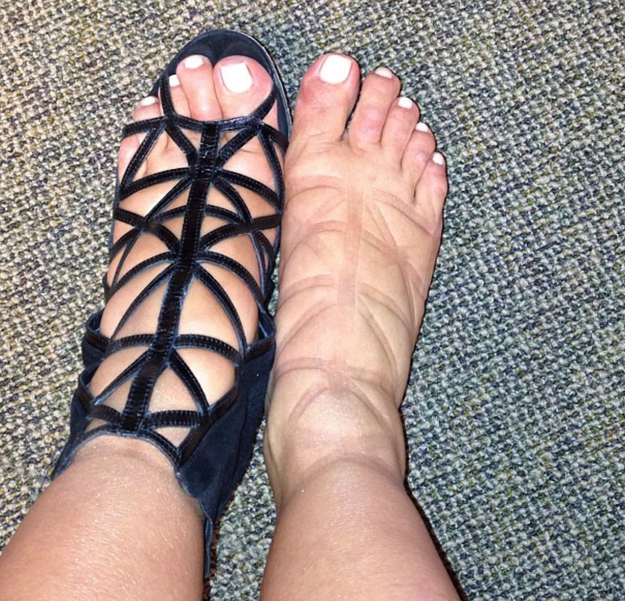 Having swollen AF pregnancy feet (these just so happen to be Kim Kardashian West's)...