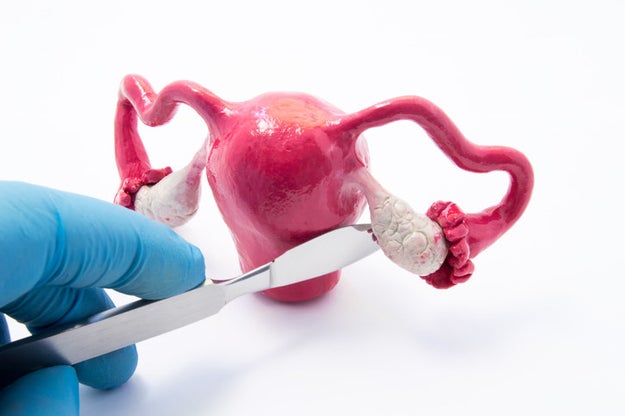 In 1809, 45-year-old Jane Todd Crawford was misdiagnosed by two physicians who told her she was pregnant with twins. A third doctor, Dr. Ephraim McDowell, offered a different diagnosis: He believed that Crawford had a large ovarian tumor and offered to remove it in an experimental surgery that had never been performed before. Without the use of anesthetics or antibiotics, McDowell removed a 22-pound ovarian tumor in the first-ever ovariotomy. Crawford recovered from the operation and died at age 78.