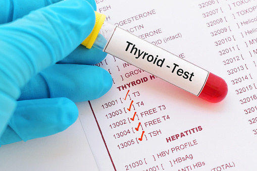 A blood test can catch thyroid problems before you even have symptoms.