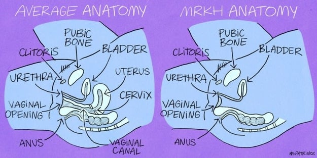 Abnormal anatomy.
