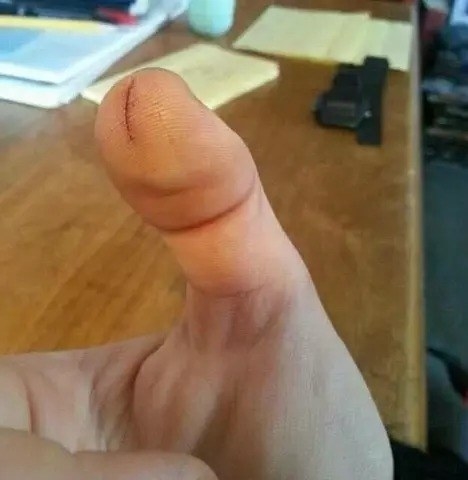 Technically, this is just a cut on someone's thumb, and not a penis.