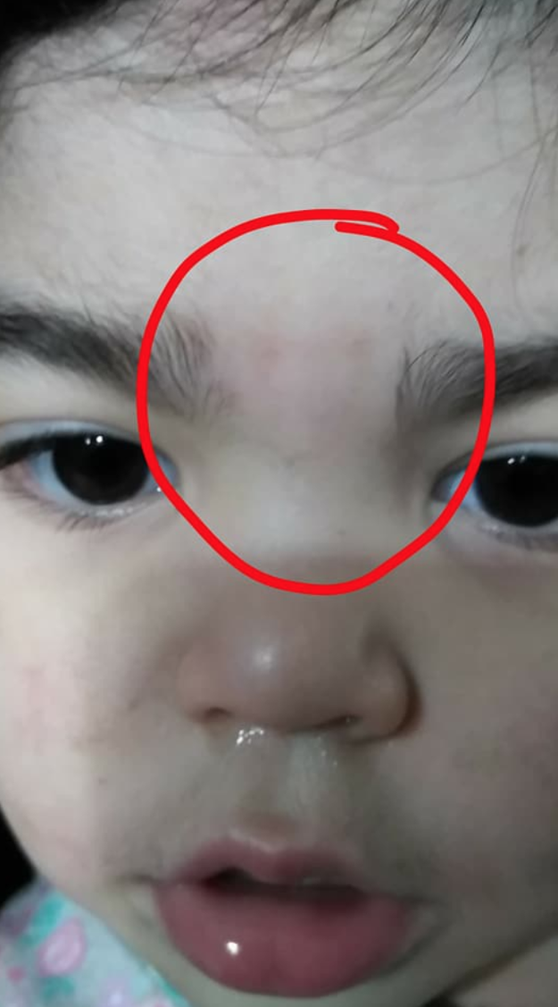 When Salgado picked up her daughter Lilayiah from daycare earlier this month, she said she noticed a "red mark in between her eyebrows." At first, she thought it was a scratch, but then she realized her toddler's eyebrows had been waxed.