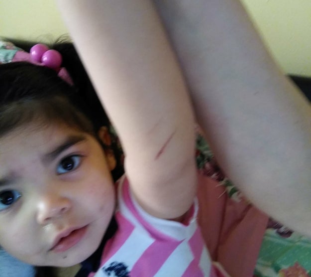 Salgado also noticed that Lilayiah's arm had been scratched.