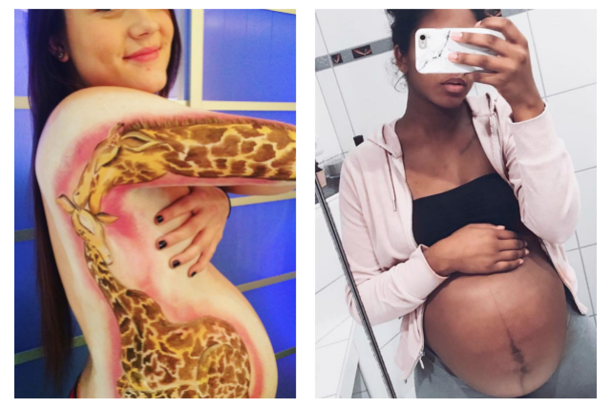 buzzfeed pregnancy photos