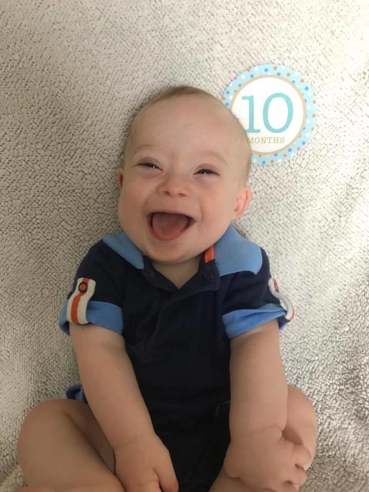 New gerber baby down sales syndrome