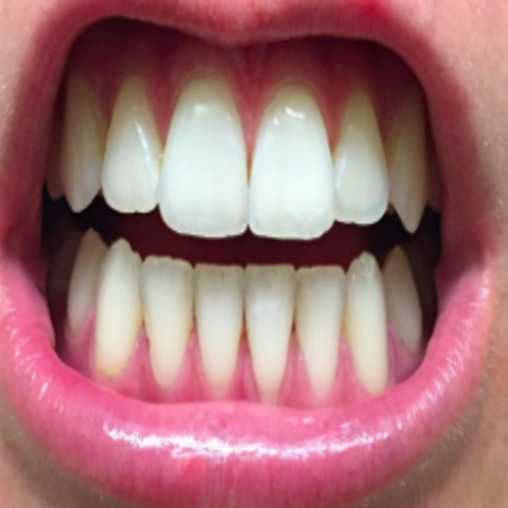 14 Teeth Whiteners That Actually Really, Really Work