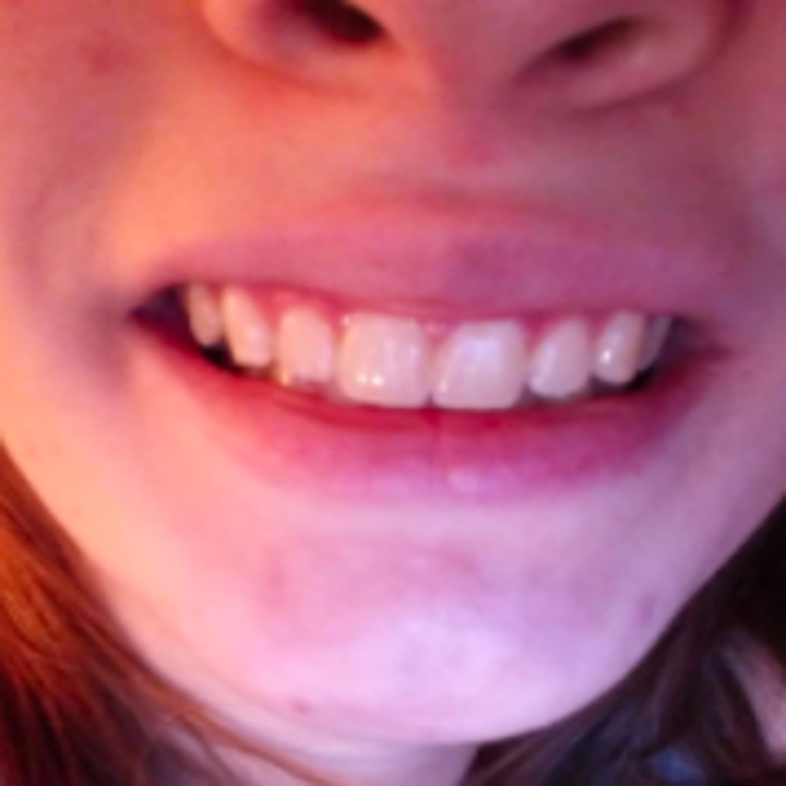 14 Teeth Whiteners That Actually Really Really Work