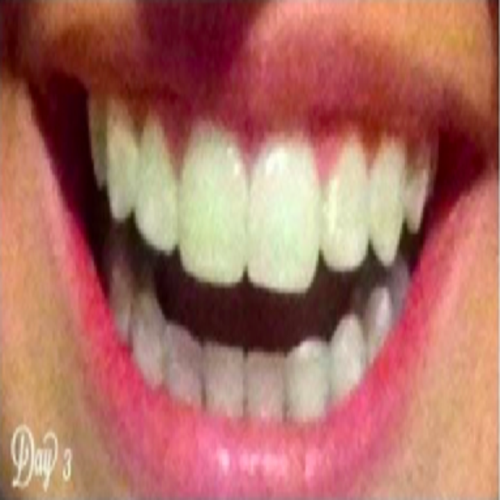 14 Teeth Whiteners That Actually Really, Really Work