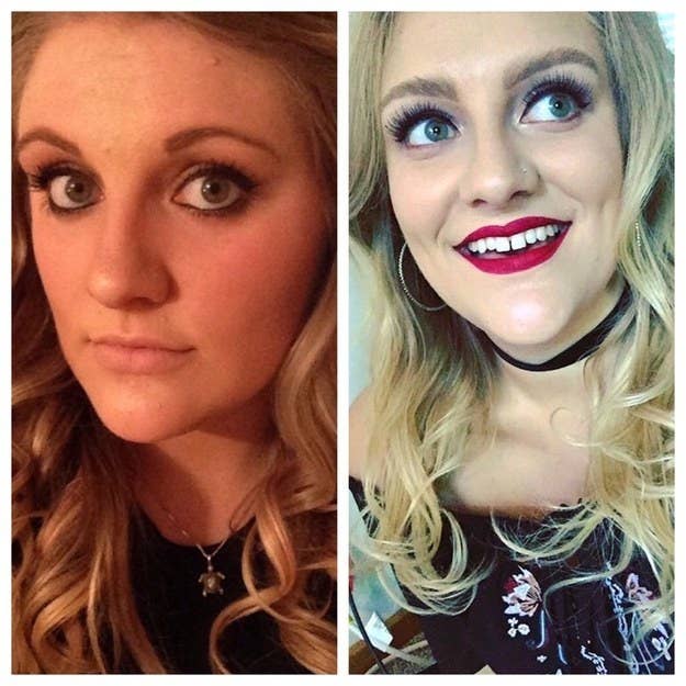 Three years difference, thank God I put down the tweezers. – Emalynw